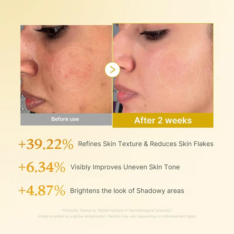 Kojic Acid Turmeric Resurfacing Toner