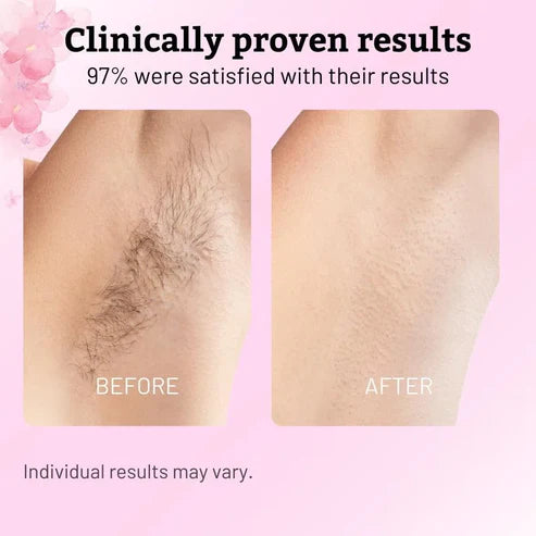 Solskin™- Cyperus Rotundus Skin Serum