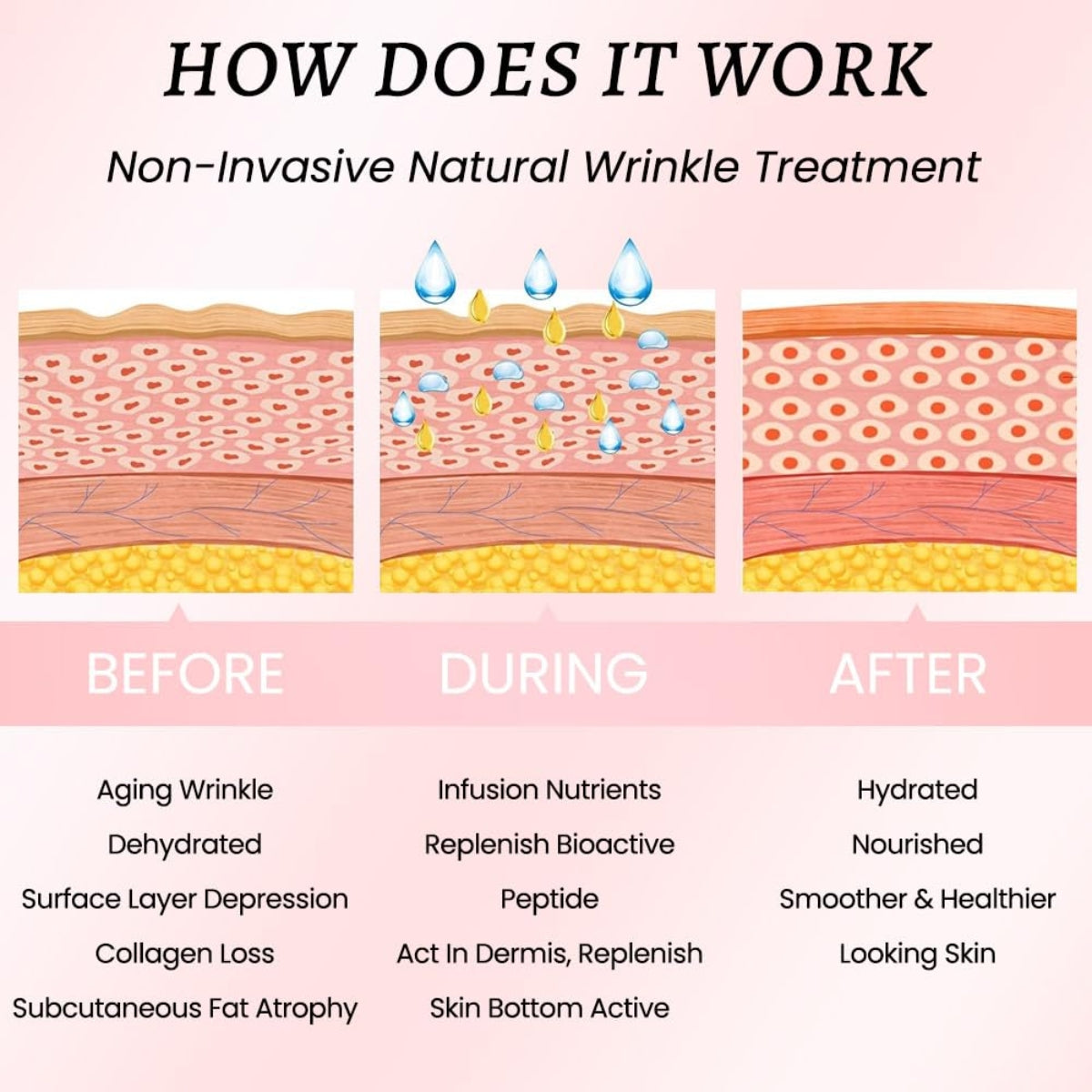 Reusable Anti-Wrinkle Patches