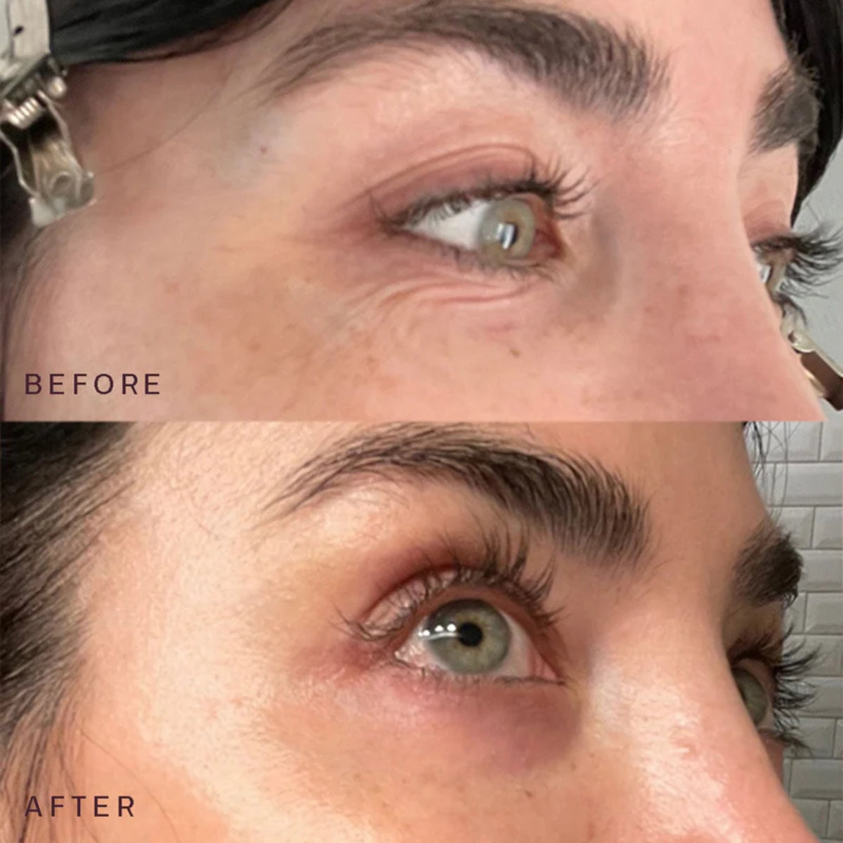 Reusable Anti-Wrinkle Patches