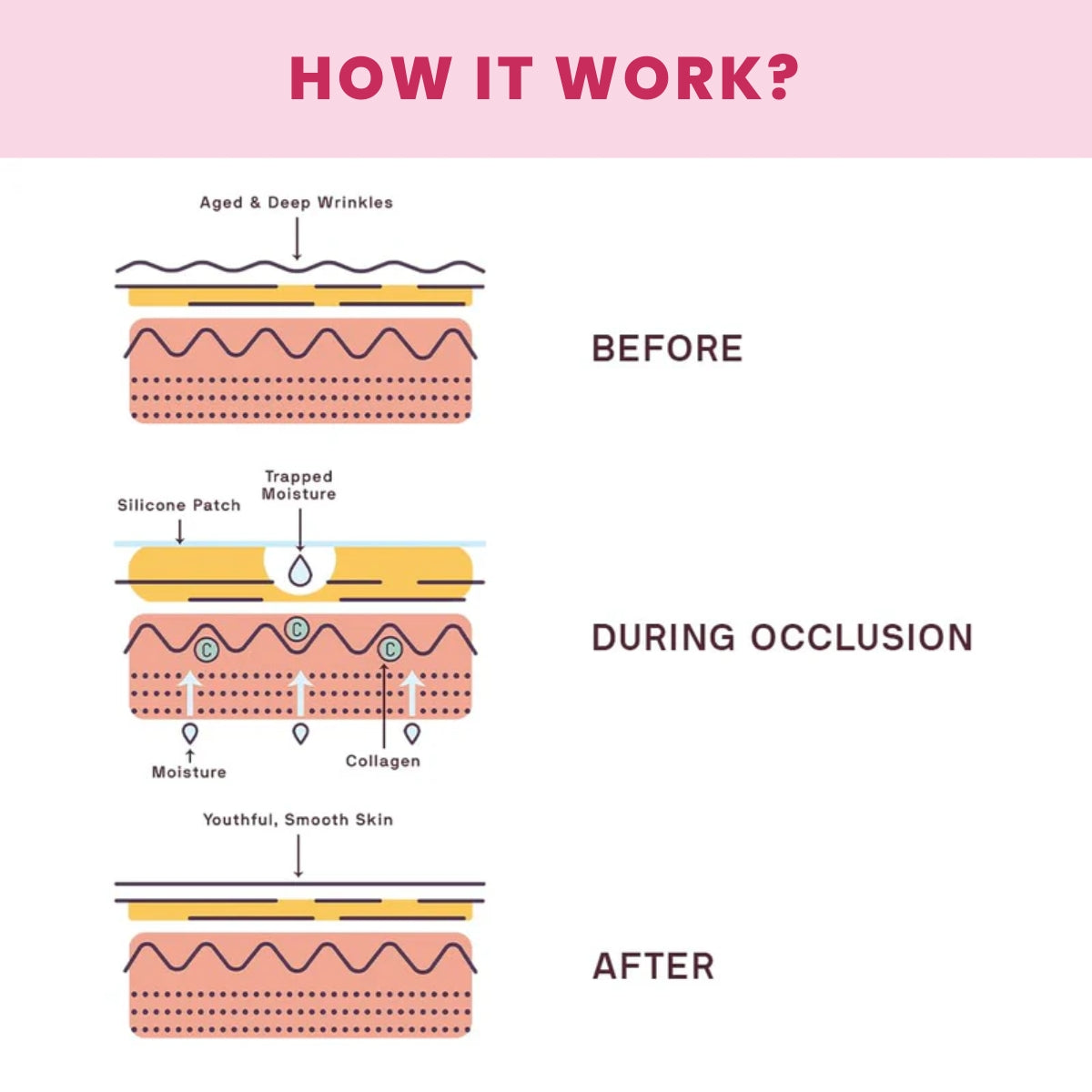 Reusable Anti-Wrinkle Patches