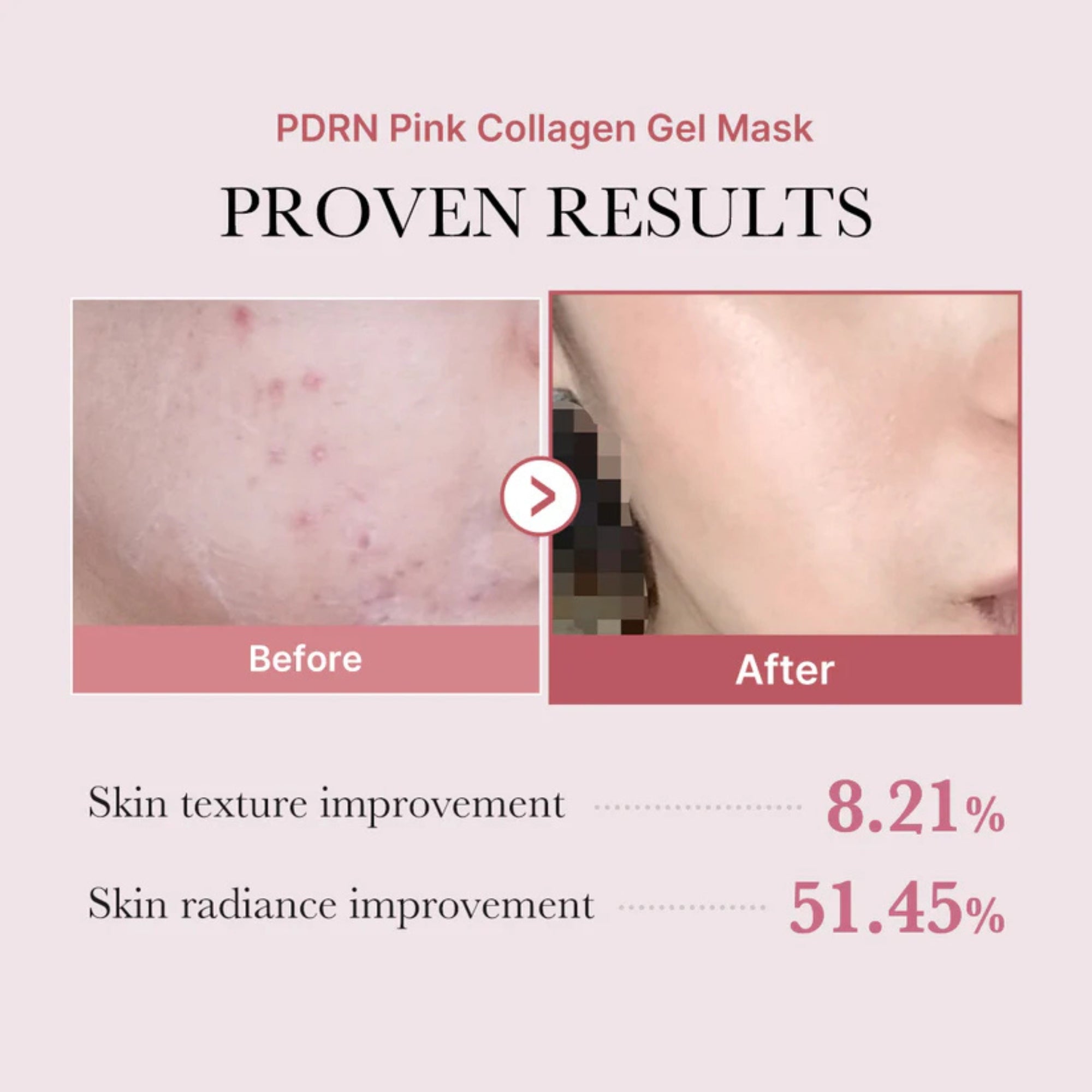 Pink PDRN Collagen Mask