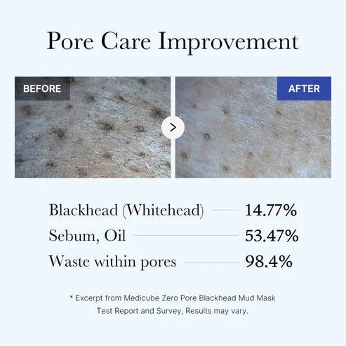 Solskin™ Zero Pore Blackhead Mud Mask.