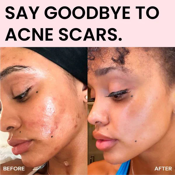 Lumi Pore & Spot Care Duo