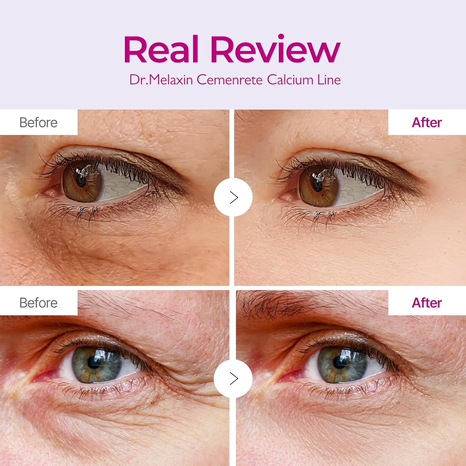 Cemenrete Calcium Multi Balm