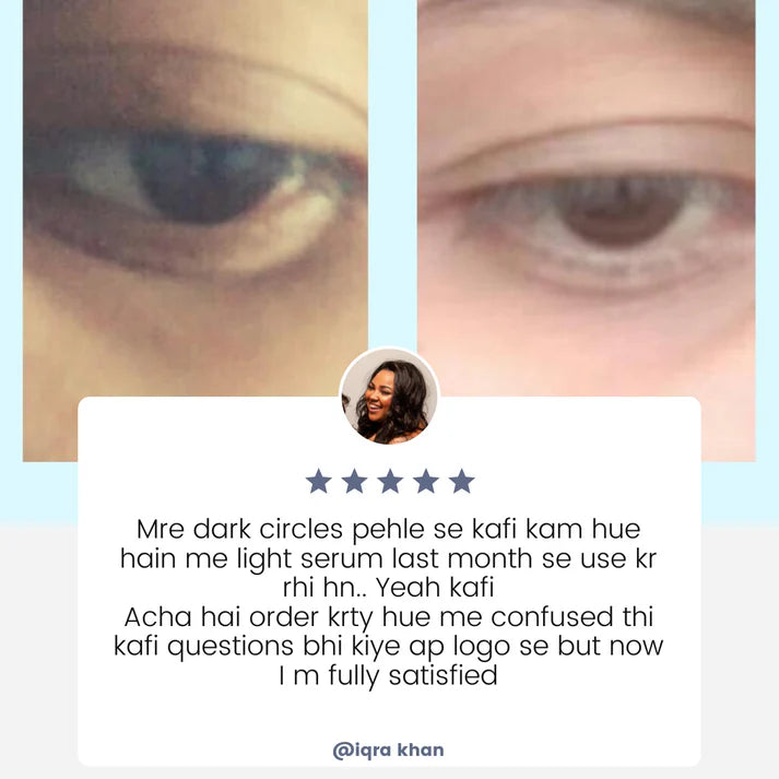 Dark Circle Correcting Serum