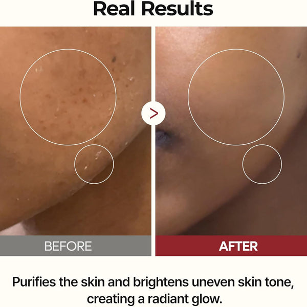 Peel Shot Glow Rice Toner