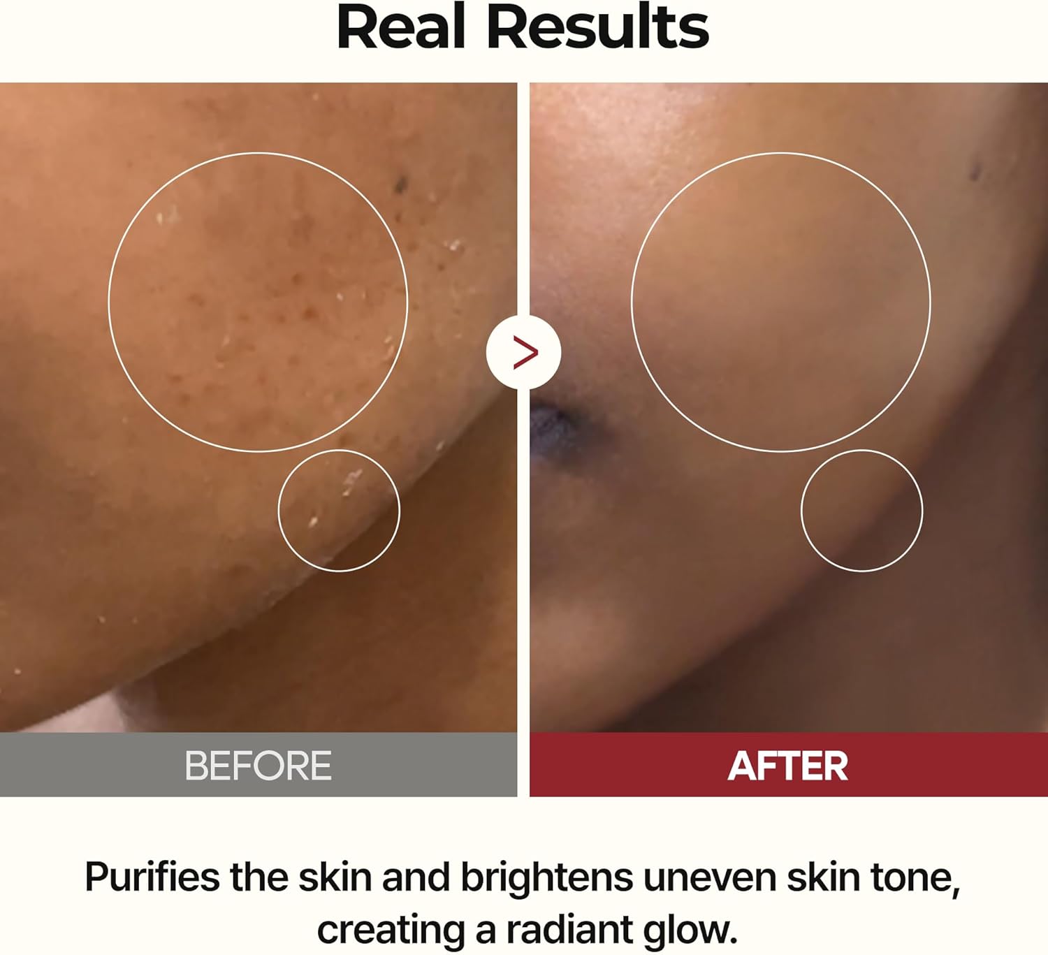 Peel Shot Glow Rice Toner