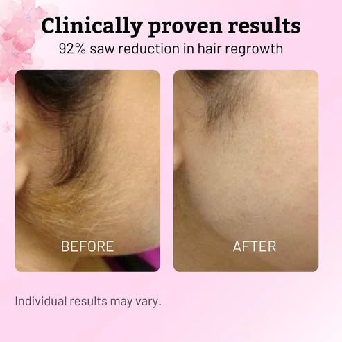 Solskin™- Cyperus Rotundus Skin Serum