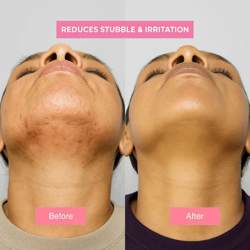 Solskin™- Cyperus Rotundus Skin Serum