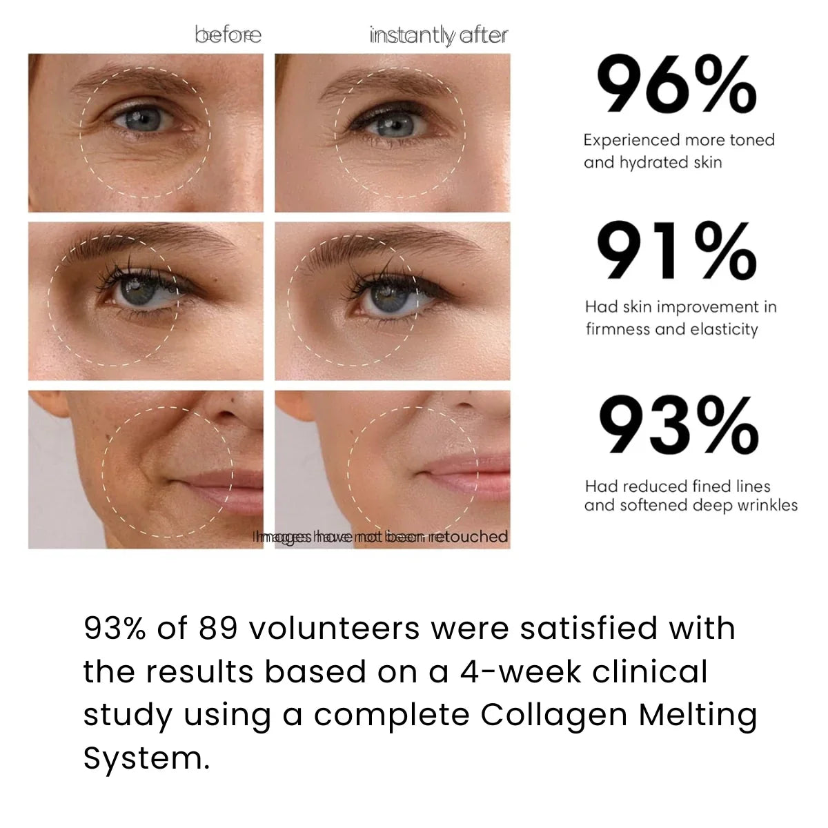 Collagen Melting Patches - 6pcs Set