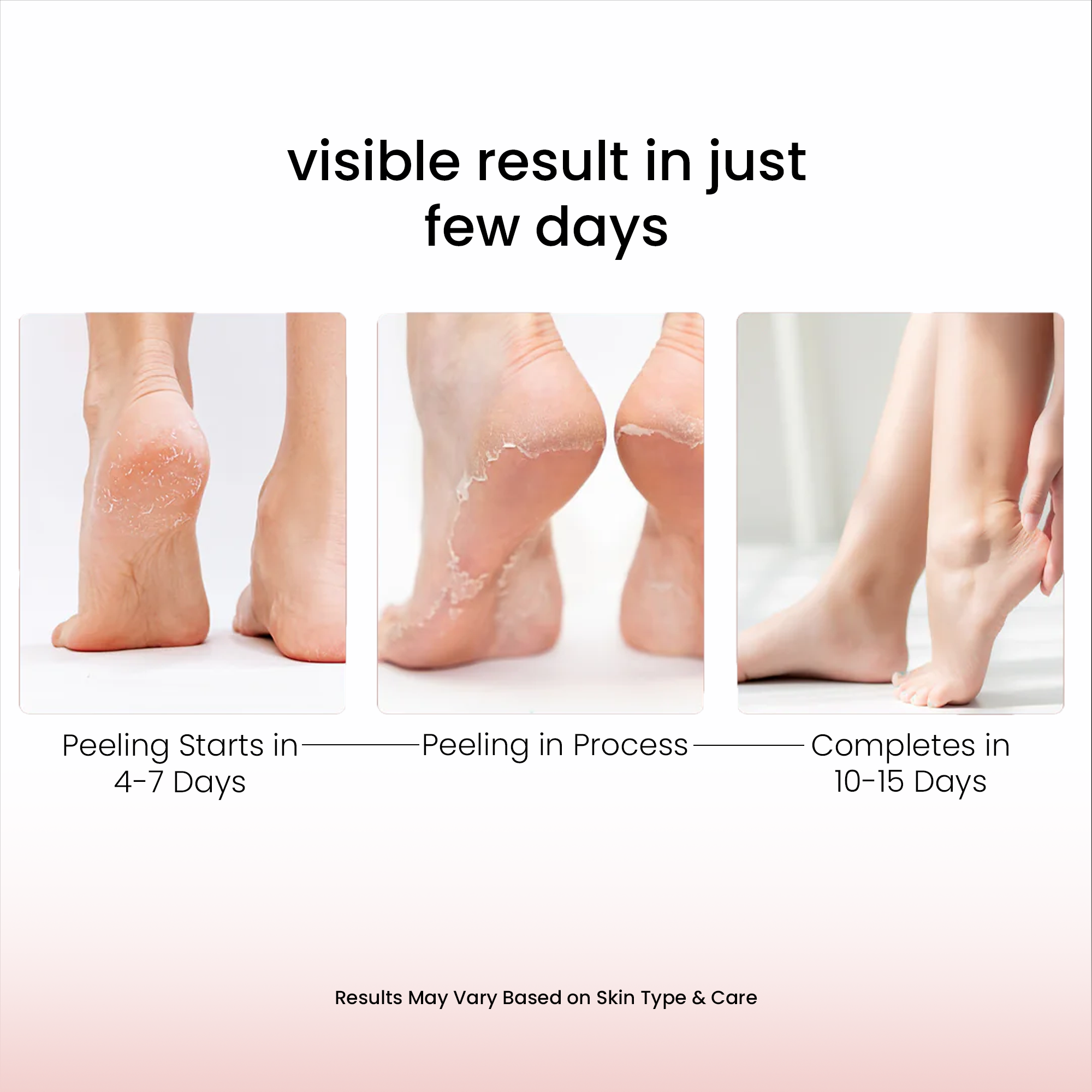 Glycolic Acid Foot Peeling Mask